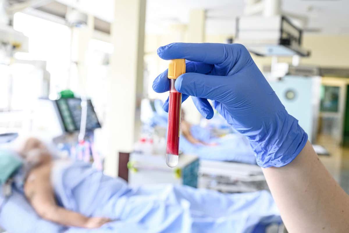 Easy blood check tweak may just make extensive care remedy more secure