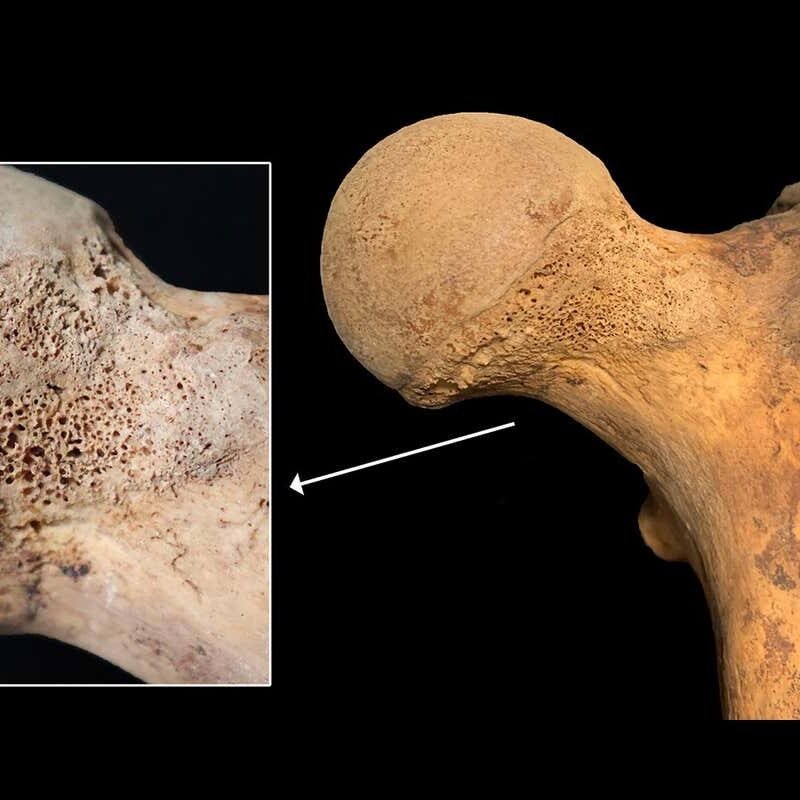 Strains of hashish present in pre-modern human bones for the primary time