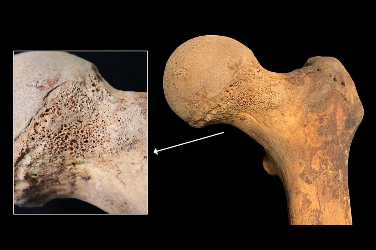 Strains of hashish present in pre-modern human bones for the primary time