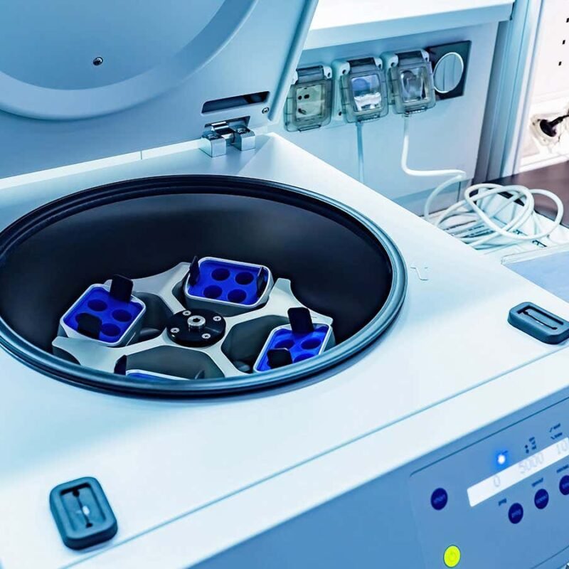 Video within centrifuge presentations we don’t absolutely perceive fluid physics Video within centrifuge presentations we don’t absolutely perceive fluid physics