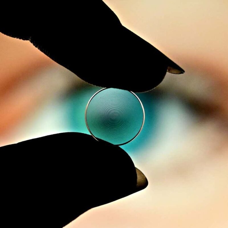 Spiral scratches on contact lenses can turn them into multifocals