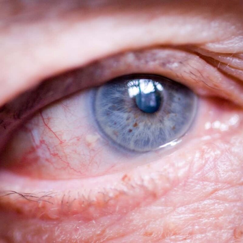 Chemical cocktail could restore sight by regenerating optic nerves Chemical cocktail could restore sight by regenerating optic nerves