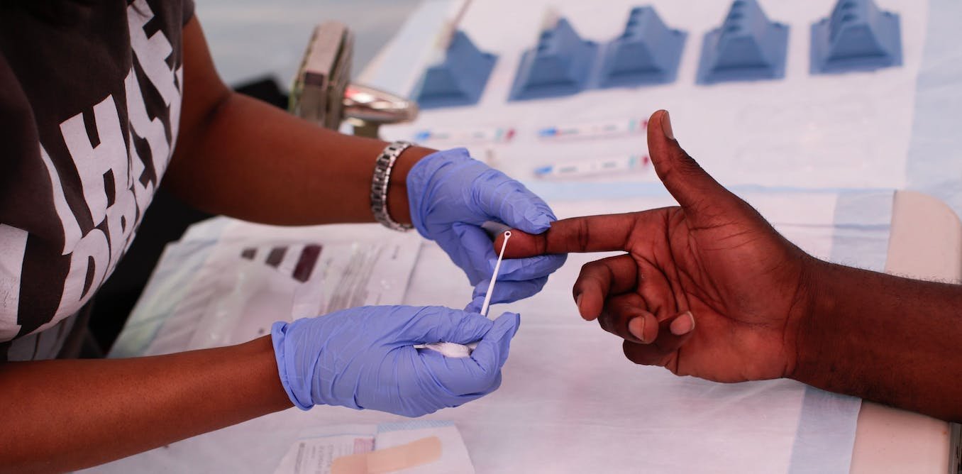 Lack of access to health care is partly to blame for skyrocketing HIV rates among gay Black men