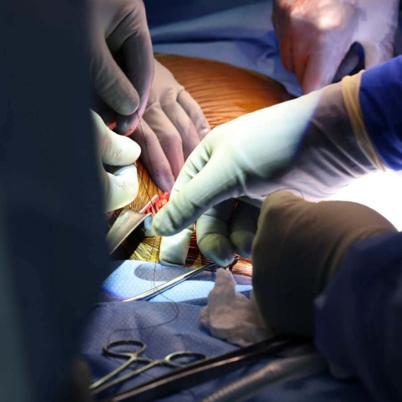 Pig kidney transplanted into living human for the first time