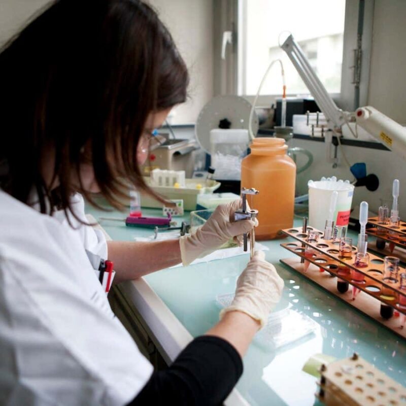 Do bone marrow transplants transmit Alzheimer’s disease?