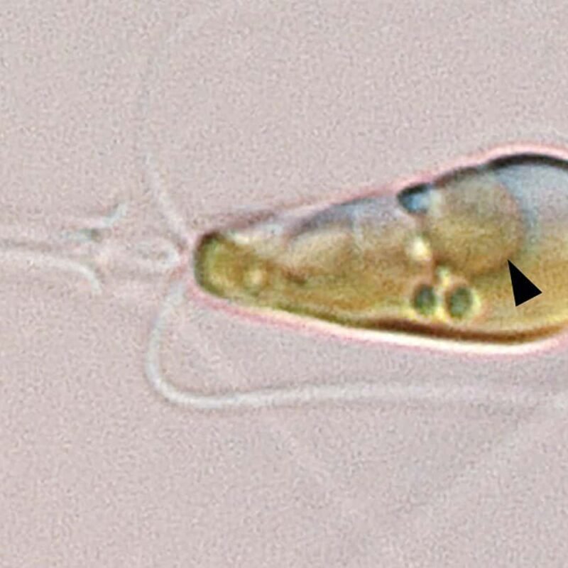 A bacterium has evolved into a new cellular structure inside algae