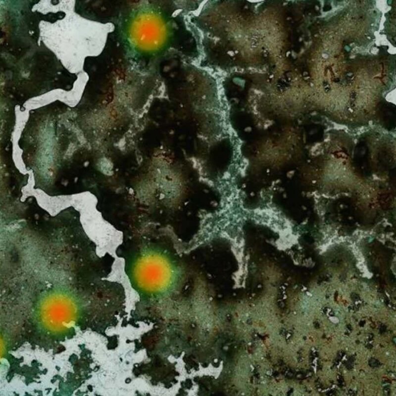 AI can spot parasites in stool samples to help diagnose infections