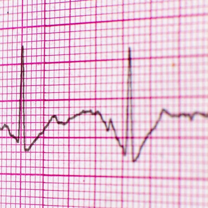 Quantum diamond sensor measured heart signals from a living rat