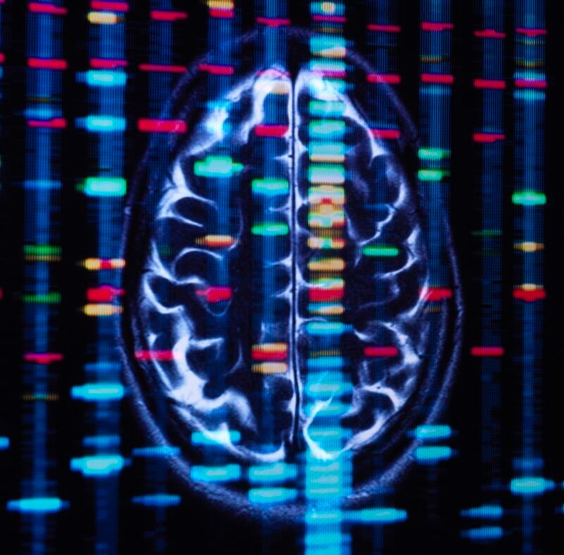 African ancestry genes linked to higher risk for Alzheimer’s, stroke : Shots