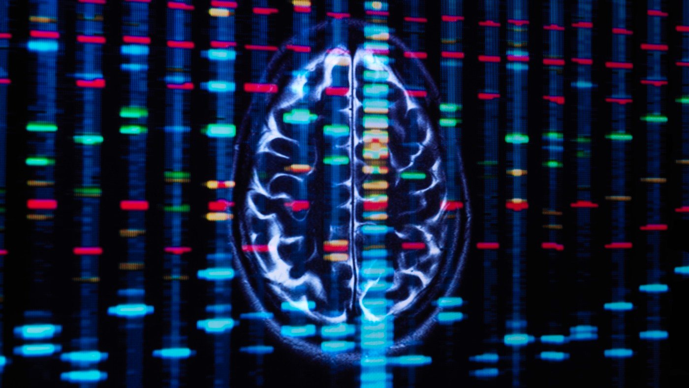 African ancestry genes linked to higher risk for Alzheimer’s, stroke : Shots