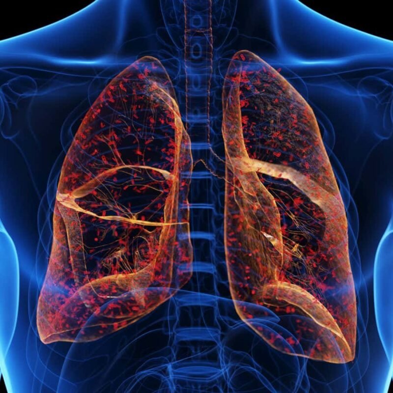 Lung-targeted CRISPR therapy offers hope for cystic fibrosis
