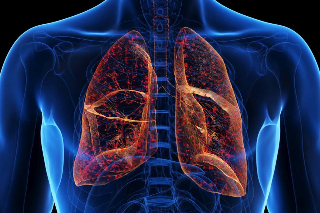 Lung-targeted CRISPR therapy offers hope for cystic fibrosis