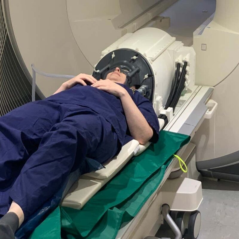 Precision ultrasound could treat deep parts of brain without surgery