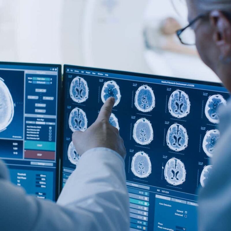 Gene therapy could prevent the tau tangles linked with Alzheimer's