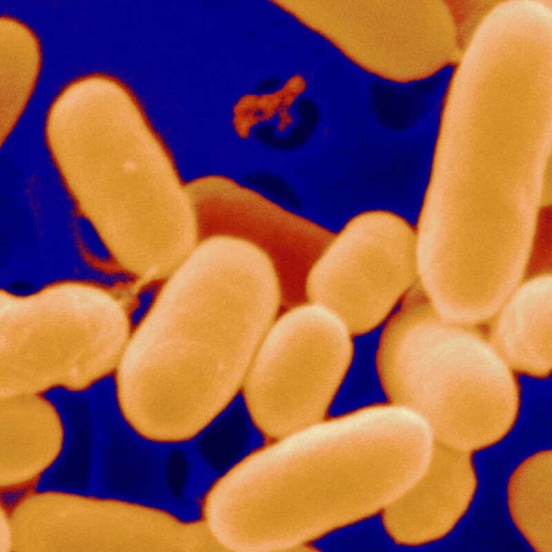 Bacteria originally found in faeces help chronic wounds heal