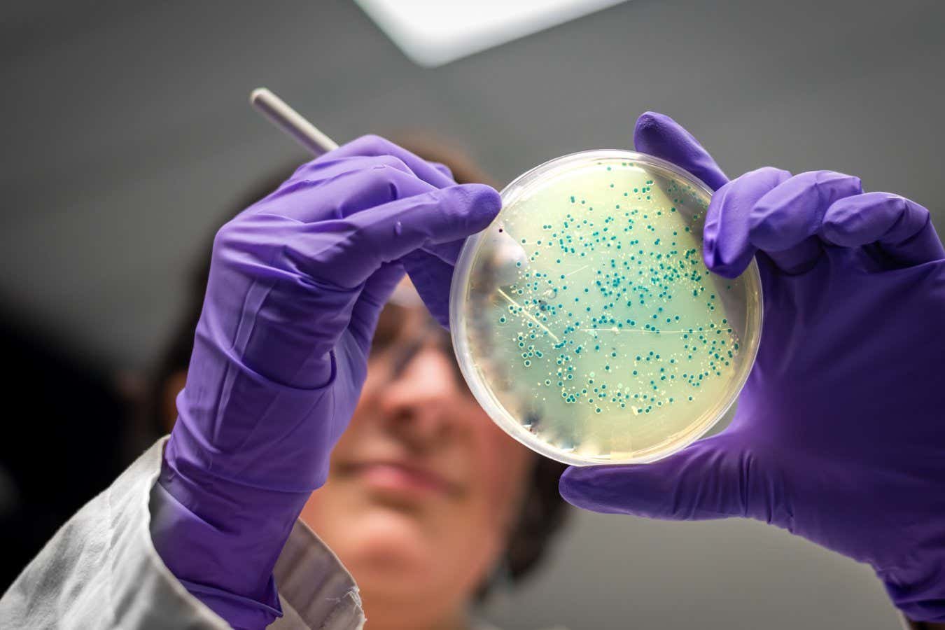 Antibiotic resistance forecast to kill 39 million people by 2050