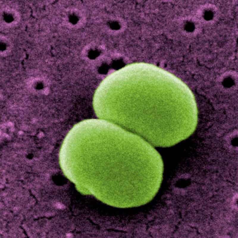 Electric skin patch could keep wounds free of infection