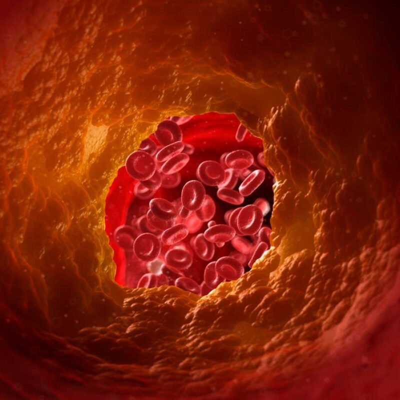 CAR T-cell therapy could help prevent clogged arteries