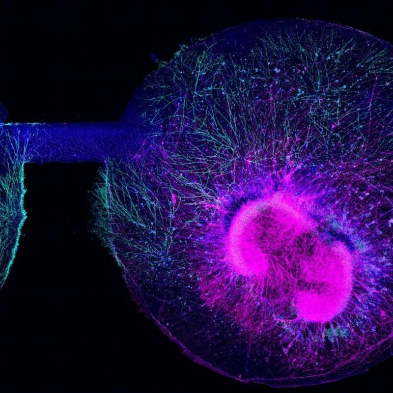 Mini-brains have been fused to resemble that of a 40-day-old fetus